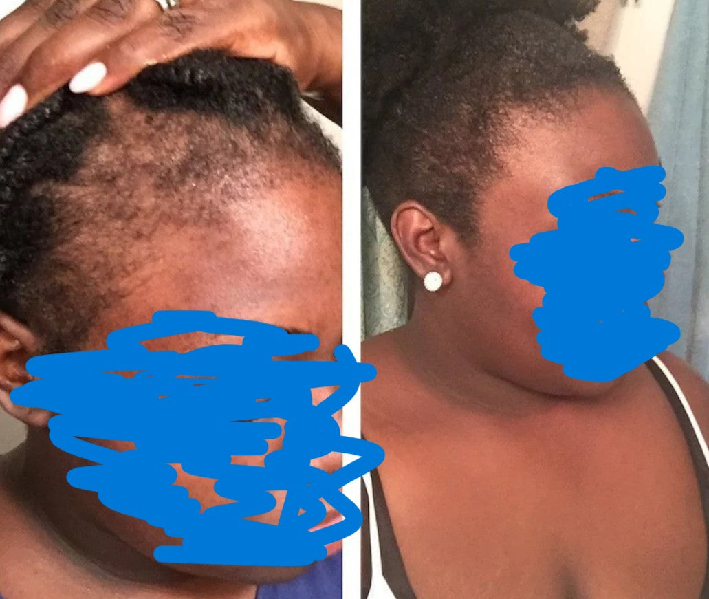 Root Rx Collection by Tenacious Beauty™ (Pre-Sale)