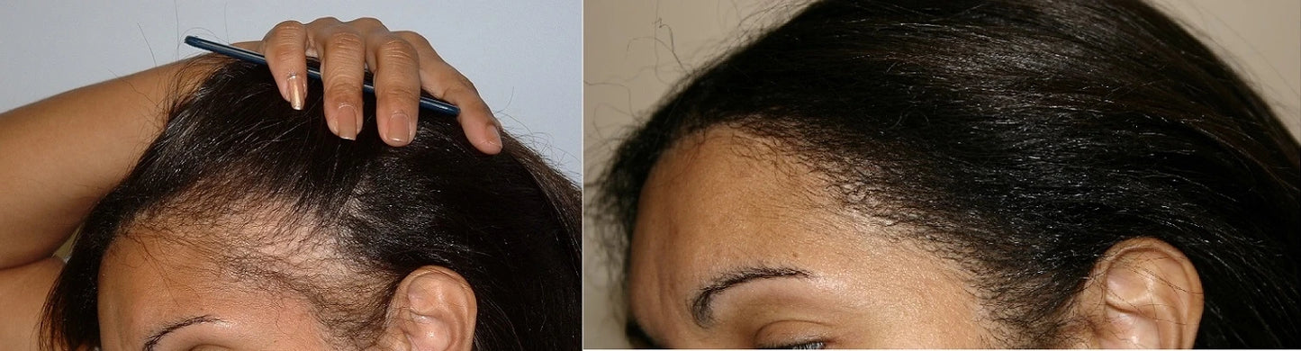 Root Rx Collection by Tenacious Beauty™ (Pre-Sale)