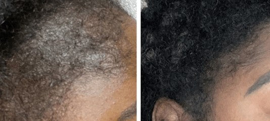 Tenacious Beauty™ Anointed Roots Collection (Pre-Sale)