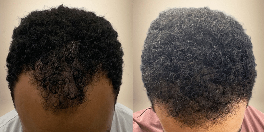 Tenacious Beauty™ Anointed Roots Collection (Pre-Sale)