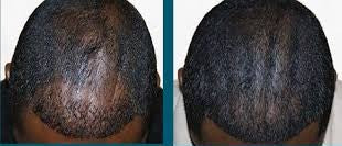 Root Rx Collection by Tenacious Beauty™ (Pre-Sale)