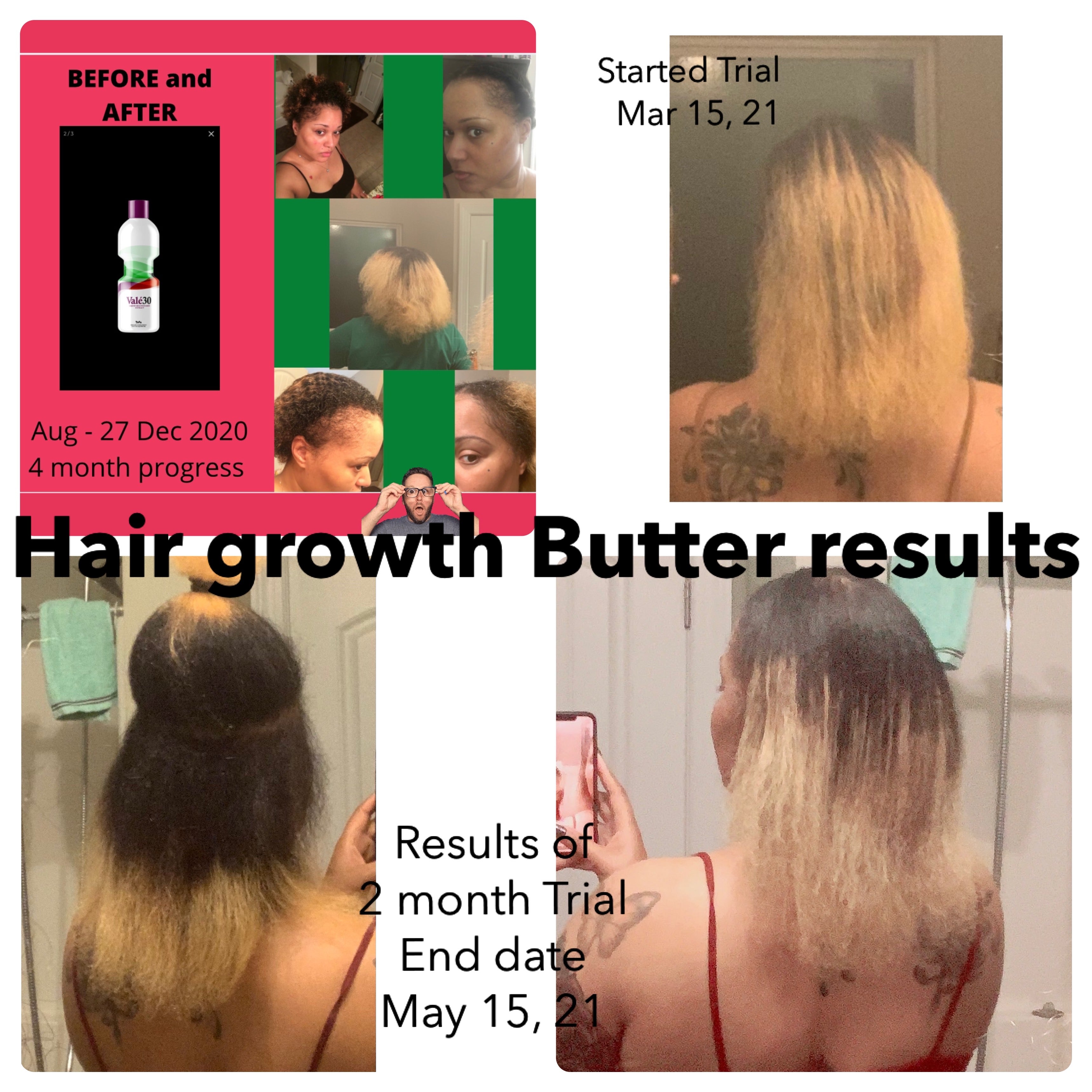 Super Hair Growth Butter with Lavender